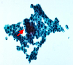 요세포검사_현미경