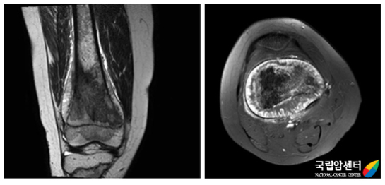 자기공명영상(MRI)
