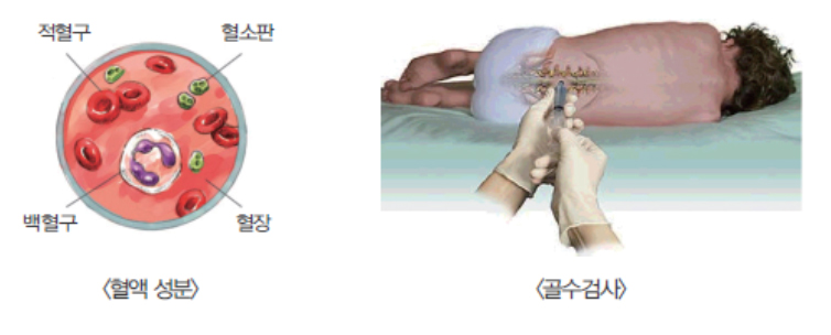 혈액 성분 및 골수검사