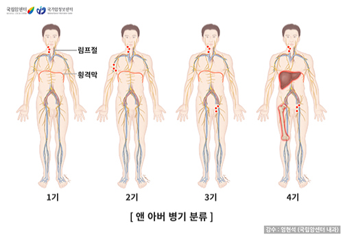 앤 아버(Ann Arbor) 병기 분류