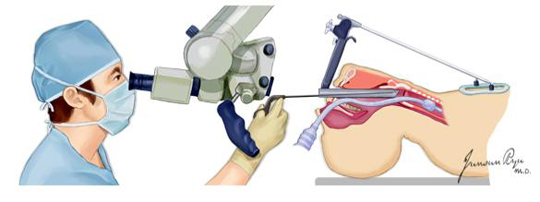 전신 마취하의 후두검사